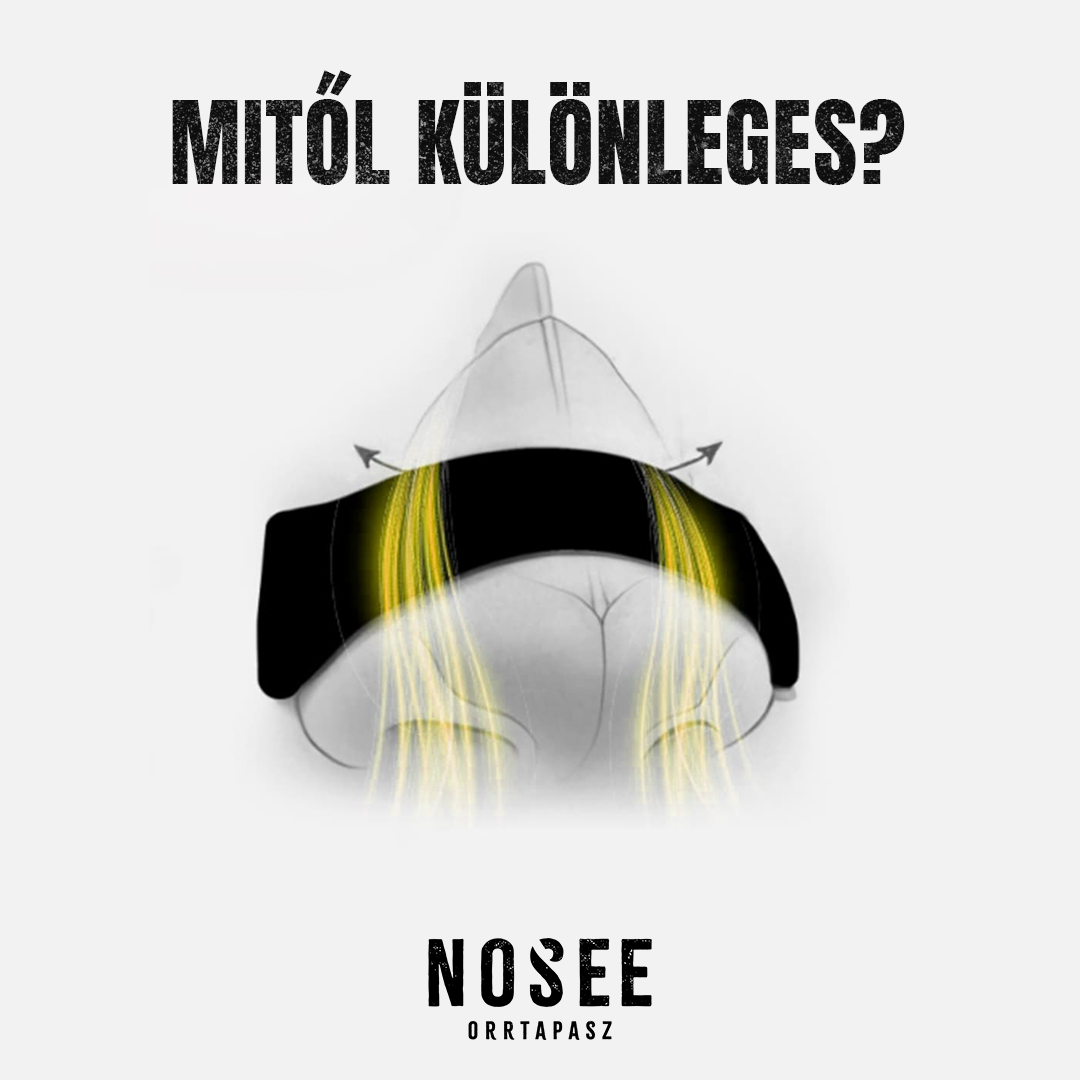 Miert_kulonleges