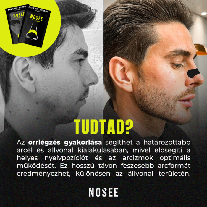 Nosee orrtapasz - Image 5